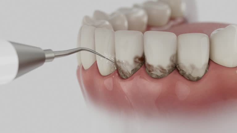 Trusted Root Canal Treatment service in North Las Vegas, NV - Dentist Open Now